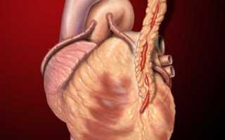 Коронарная реваскуляризация — операция на серде (шунтирование)