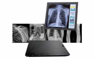 Аппарат для рентгена – что скрывается за рентгеновскими лучами?