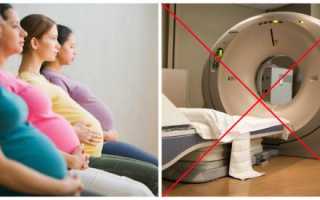 Компьютерная томография во время беременности – неоправданный риск