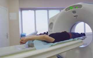 Мультиспиральная компьютерная томография – базовый метод диагностики болезней мочевыделительной системы