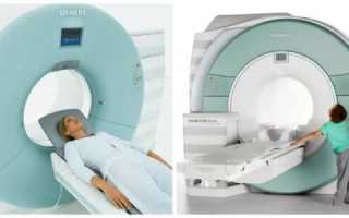 Место МРТ и КТ в диагностике заболеваний головного мозга