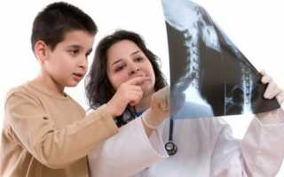 Где лучше сделать рентген ребенку?