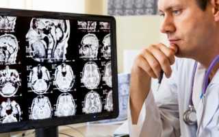 Высокоточная неинвазивная диагностика опухолей с помощью МРТ