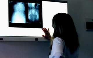 Рентген желудка с барием: что показывает исследование