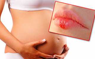 Опасен ли герпес во время беременности и нужно ли его лечить