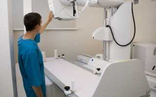 Показания и противопоказания к рентгенологическому обследованию
