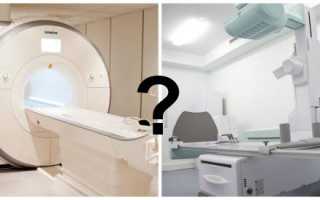 Преимущества и недостатки магнитно-резонансной томографии перед рентгенографией: чего стоит опасаться и ждать