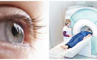 МРТ зрительного нерва и глазных орбит: роль в диагностике глазных болезней