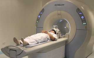 Обзорная магнитно-резонансная томография при симптомах, характерных для многих болезней