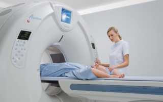 МР-томография тазобедренного сустава – показания и альтернативные способы обследования