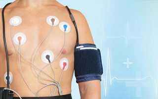 Холтеровское мониторирование в современной кардиологии