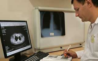 Компьютерная томография органов брюшной полости