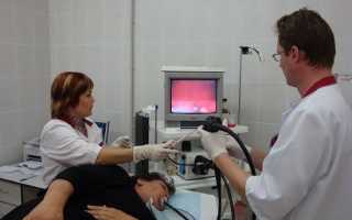 Проведение ФГДС с биопсией: показания и противопоказания, подготовка к проведению