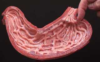 Лимфофолликулярная гиперплазия нижней части желудка