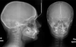 Рентгенологическое исследование черепа: суть и возможности метода