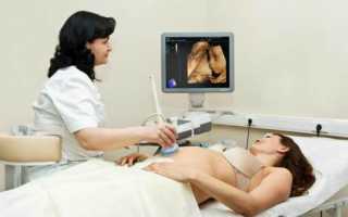 Ультразвуковое исследование на 25 неделе беременности