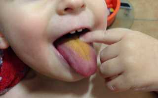 Причины появления жёлтого налёта на языке у ребёнка