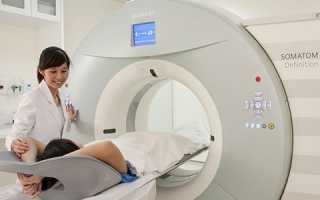 Какие возможности имеет компьютерная томография при обследовании органов малого таза у женщин